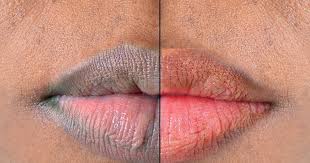 10 Ways To Help Maintain Your Lips